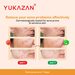 Yukazan Derma Refining Cream Acne & Pore 5ml Acne Removal Cream - Reduce acne in 7 days