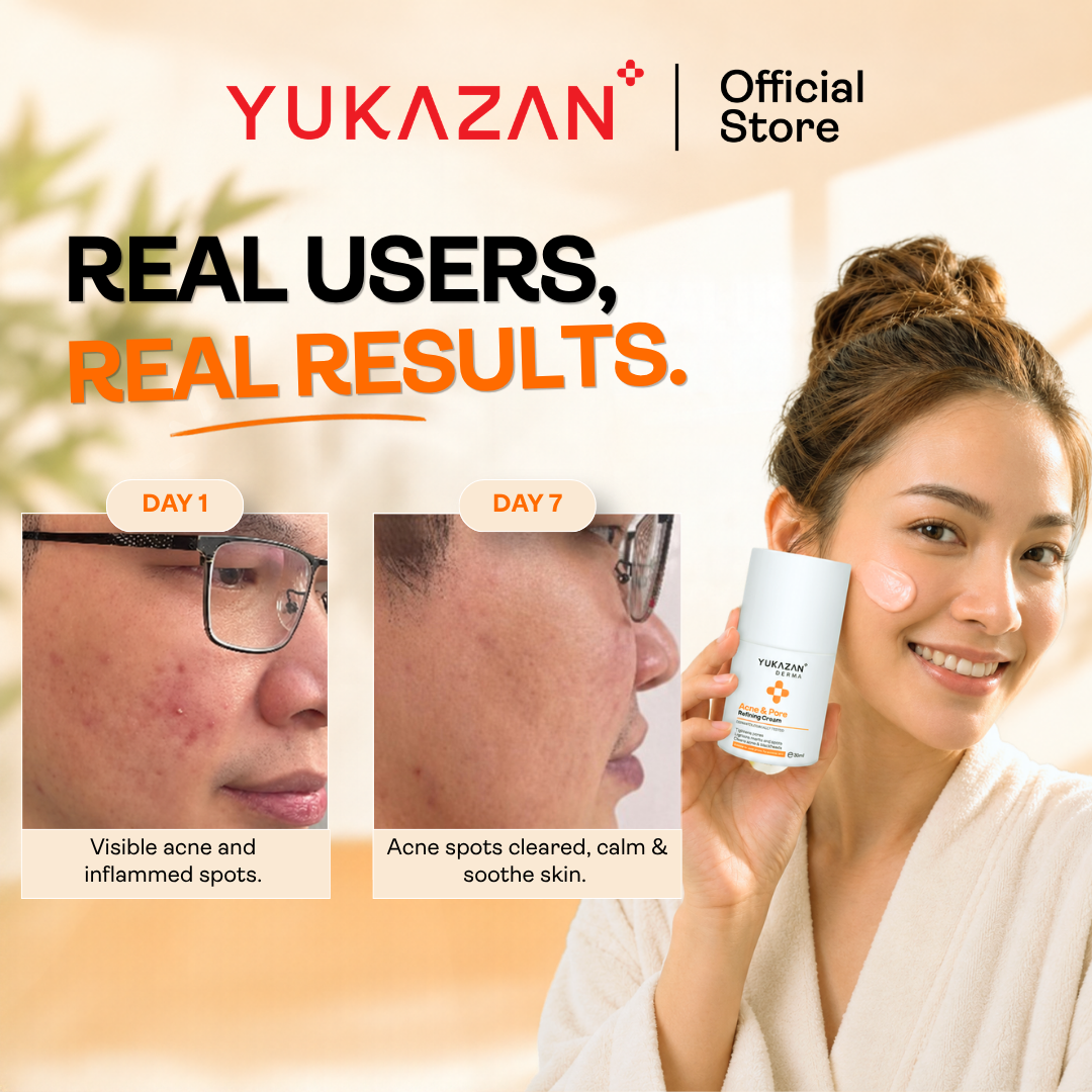 Yukazan Derma Refining Cream Acne & Pore 30ml Acne Removal Cream - Reduce acne in 7 days